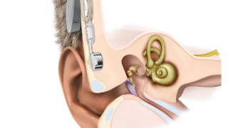 Ear diseases and hearing problems in children and adults